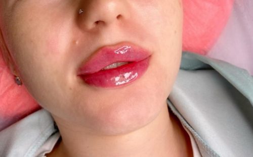 Chaeum Premium 2 photo review