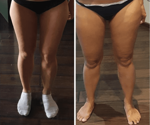 Lipo Lab PPC photo review