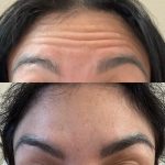 Nabota 200 Units photo review