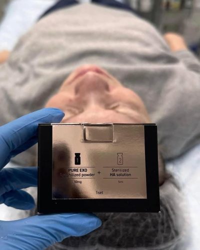 Exoxe face photo review