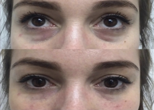 AMI eyes photo review